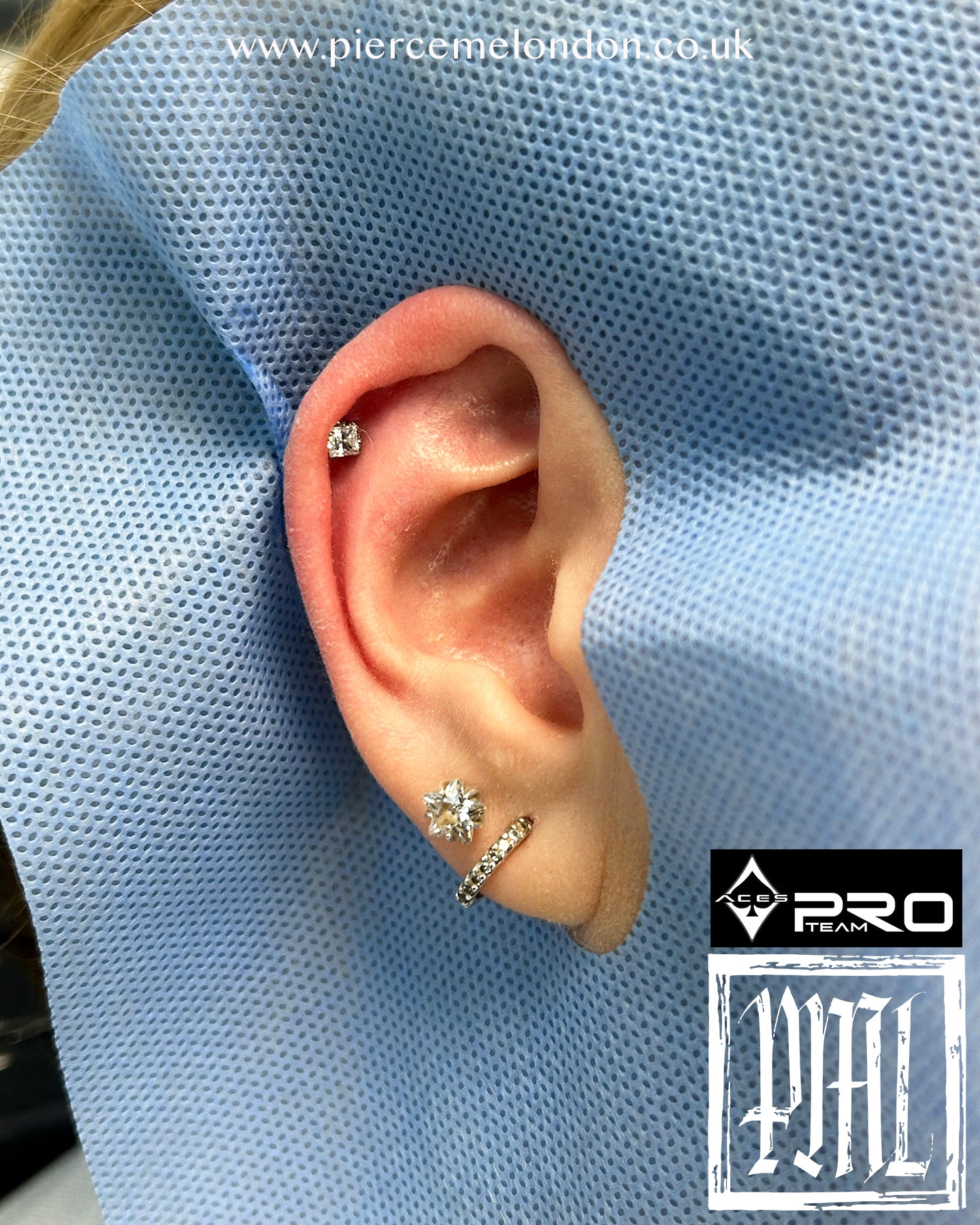 Axel Square Prong Set Low Profile End