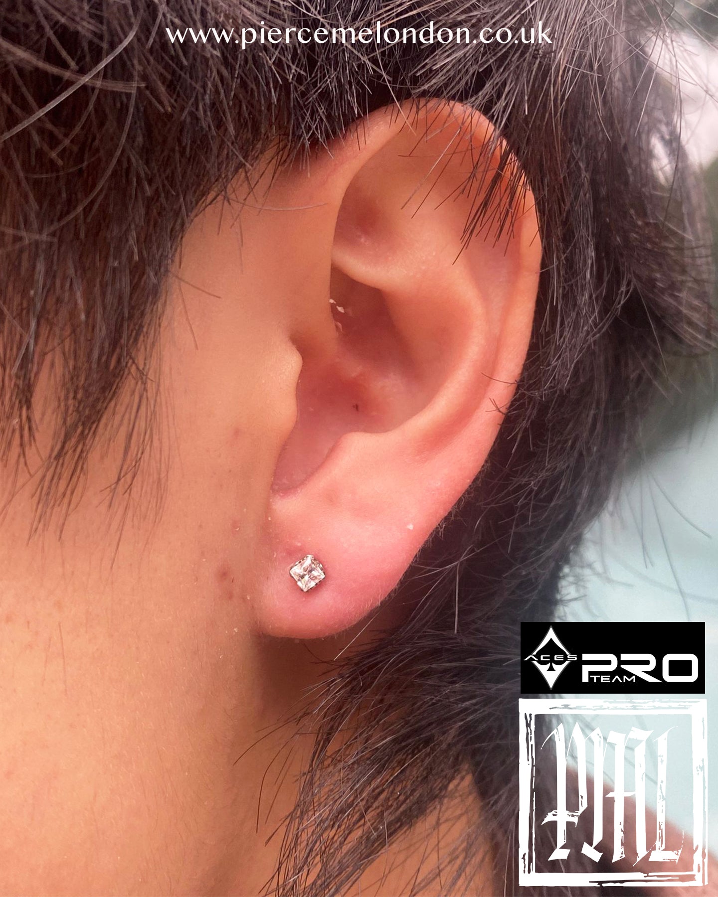 Axel Square Prong Set Low Profile End