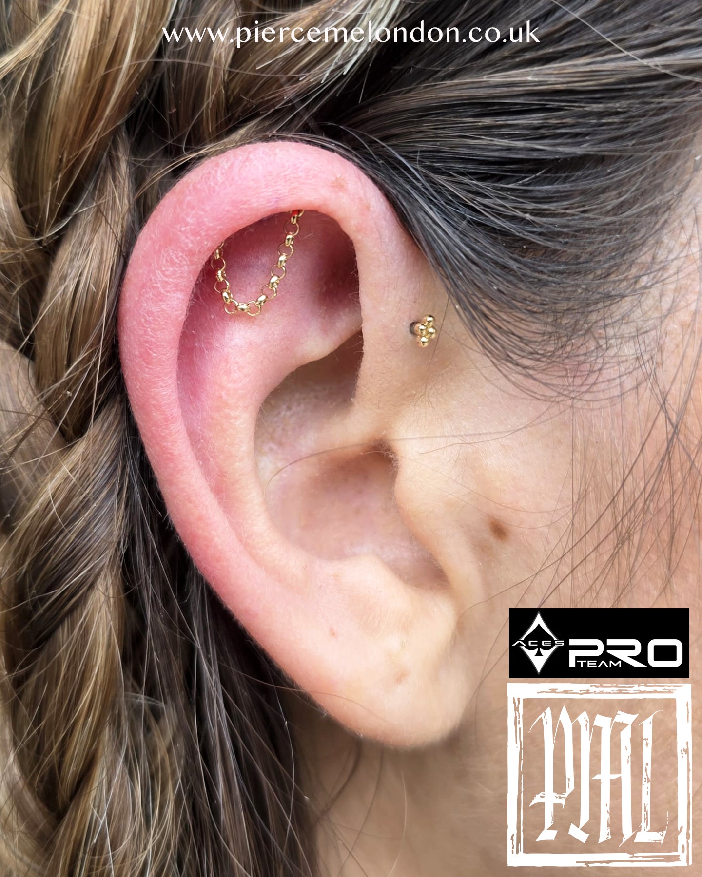 Short Legato Attachment YG